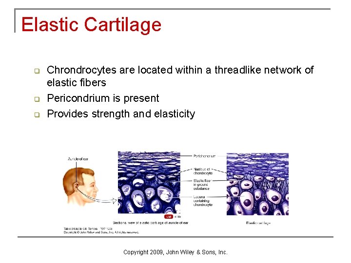 Elastic Cartilage q q q Chrondrocytes are located within a threadlike network of elastic