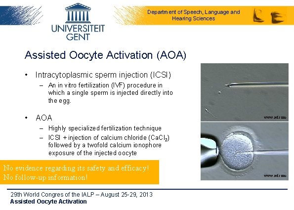 Department of Speech, Language and Hearing Sciences Assisted Oocyte Activation (AOA) • Intracytoplasmic sperm