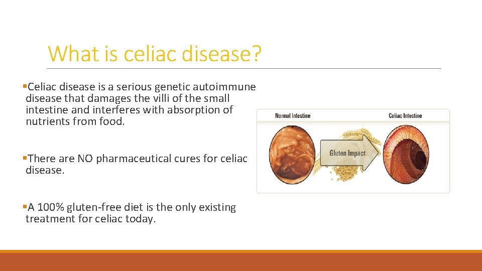 What is celiac disease? §Celiac disease is a serious genetic autoimmune disease that damages