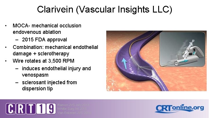 Clarivein (Vascular Insights LLC) • • • MOCA- mechanical occlusion endovenous ablation – 2015