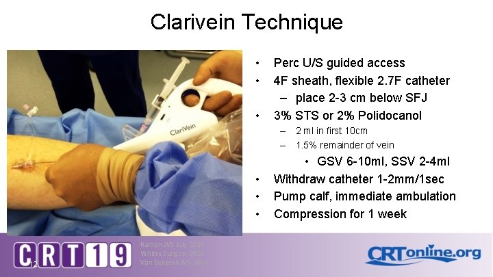 Clarivein Technique • • • Perc U/S guided access 4 F sheath, flexible 2.