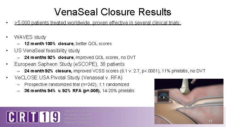 Vena. Seal Closure Results • >5, 000 patients treated worldwide, proven effective in several