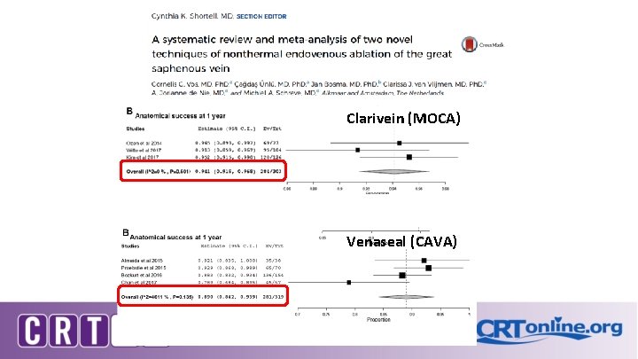 Clarivein (MOCA) Venaseal (CAVA) JVS 2017 