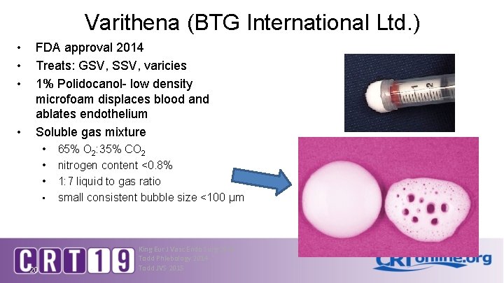 Varithena (BTG International Ltd. ) • • FDA approval 2014 Treats: GSV, SSV, varicies