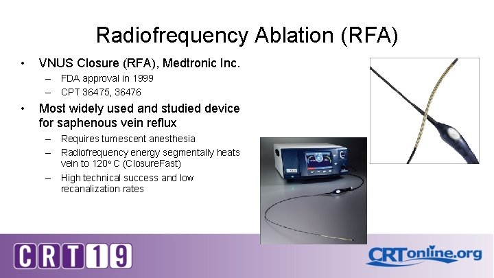 Radiofrequency Ablation (RFA) • VNUS Closure (RFA), Medtronic Inc. – FDA approval in 1999