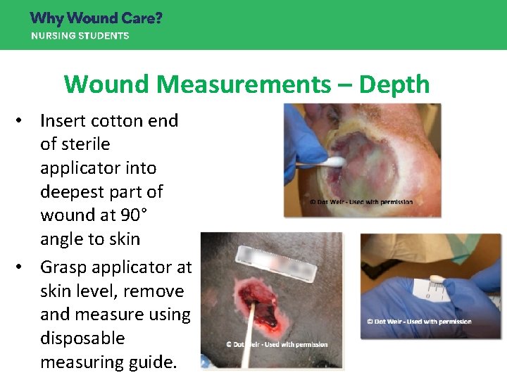 Wound Measurements – Depth • Insert cotton end of sterile applicator into deepest part Wound Measurements – Depth • Insert cotton end of sterile applicator into deepest part