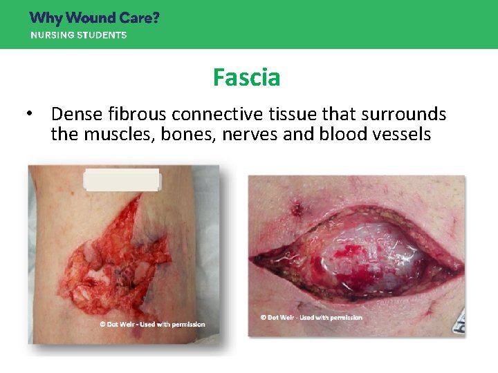 Fascia • Dense fibrous connective tissue that surrounds the muscles, bones, nerves and blood Fascia • Dense fibrous connective tissue that surrounds the muscles, bones, nerves and blood