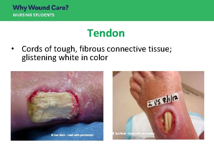 Tendon • Cords of tough, fibrous connective tissue; glistening white in color Tendon • Cords of tough, fibrous connective tissue; glistening white in color