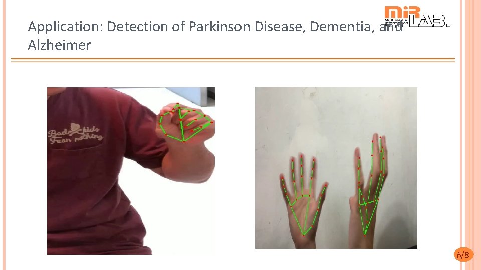 Application: Detection of Parkinson Disease, Dementia, and Alzheimer 6/8 