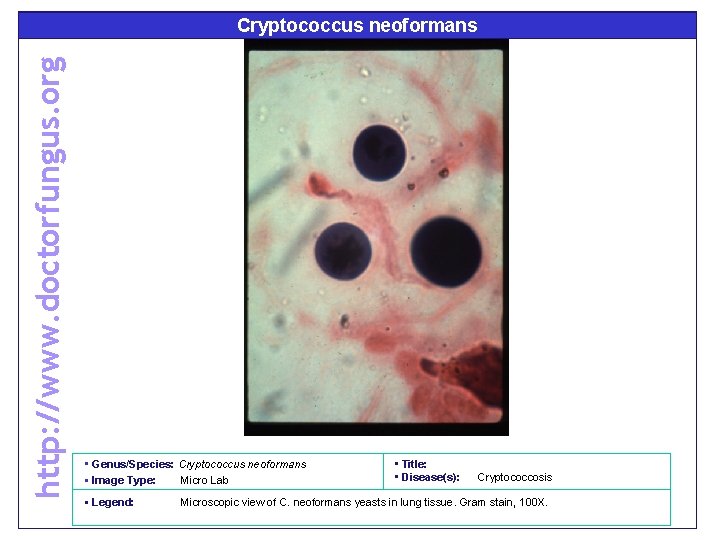 http: //www. doctorfungus. org Cryptococcus neoformans • Genus/Species: Cryptococcus neoformans • Image Type: Micro