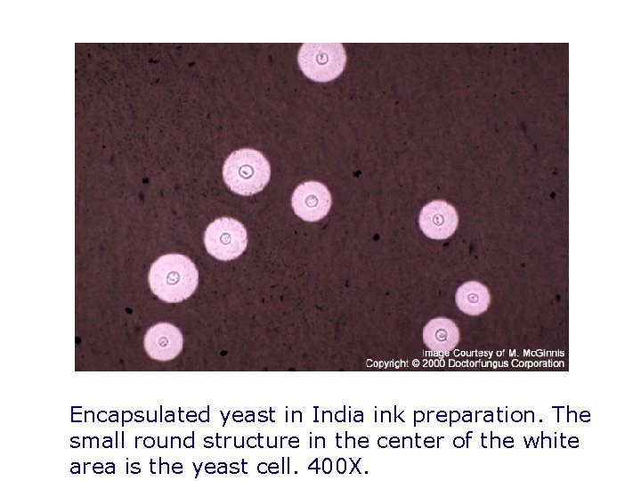Encapsulated yeast in India ink preparation. The small round structure in the center of