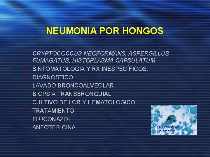 NEUMONIA POR HONGOS Ø CRYPTOCOCCUS NEOFORMANS, ASPERGILLUS FUMAGATUS, HISTOPLASMA CAPSULATUM Ø SINTOMATOLOGIA Y RX