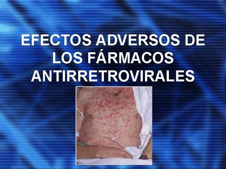 EFECTOS ADVERSOS DE LOS FÁRMACOS ANTIRRETROVIRALES 