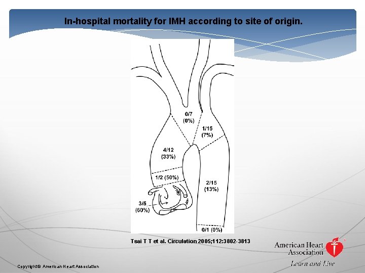 In-hospital mortality for IMH according to site of origin. Tsai T T et al.