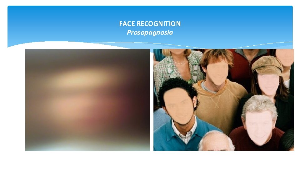 FACE RECOGNITION Prosopagnosia 