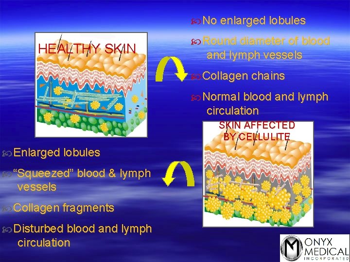  No enlarged lobules HEALTHY SKIN Round diameter of blood and lymph vessels Collagen