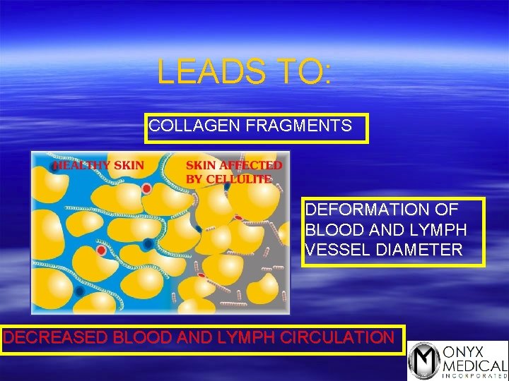 LEADS TO: COLLAGEN FRAGMENTS DEFORMATION OF BLOOD AND LYMPH VESSEL DIAMETER DECREASED BLOOD AND