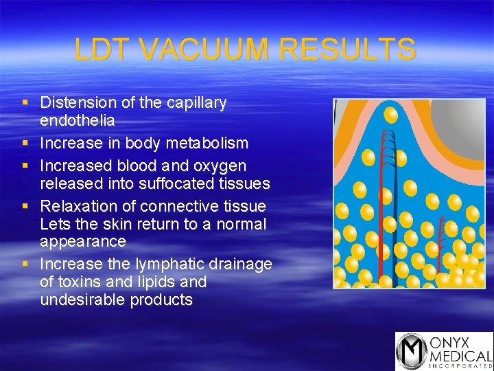 LDT VACUUM RESULTS § Distension of the capillary endothelia § Increase in body metabolism