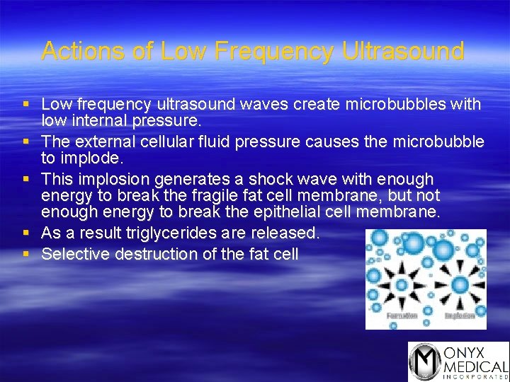 Actions of Low Frequency Ultrasound § Low frequency ultrasound waves create microbubbles with low