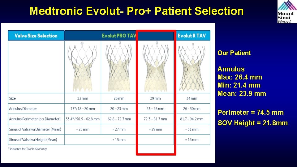 Medtronic Evolut- Pro+ Patient Selection Our Patient Annulus Max: 26. 4 mm Min: 21.