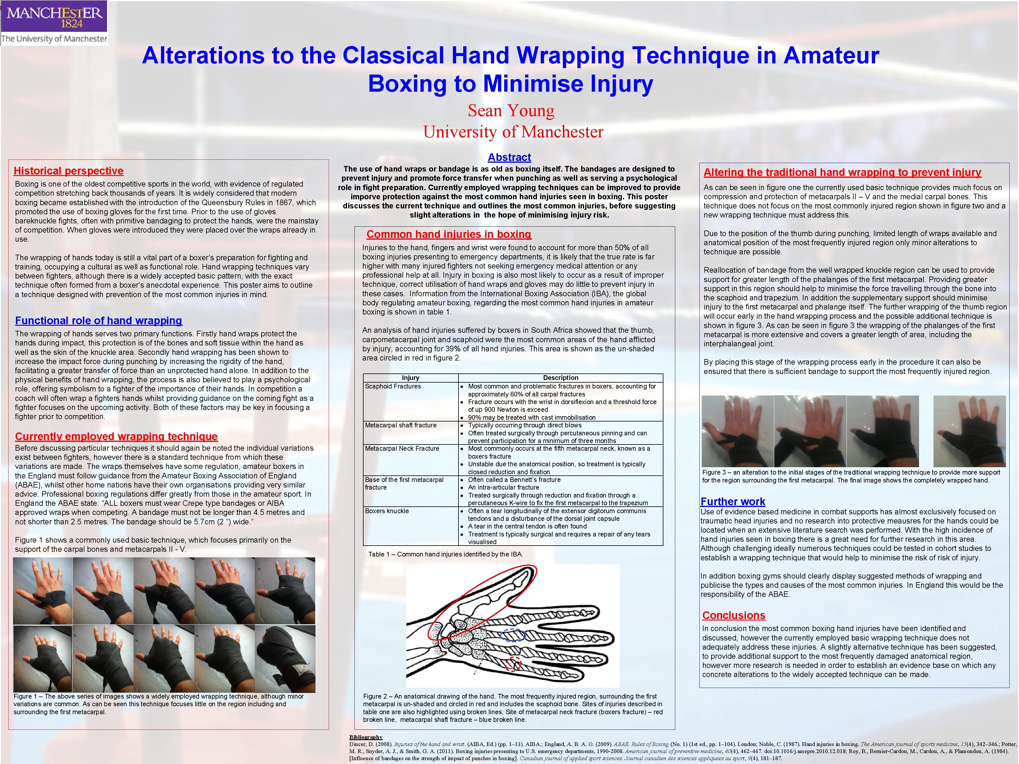 Alterations to the Classical Hand Wrapping Technique in Amateur Boxing to Minimise Injury Sean