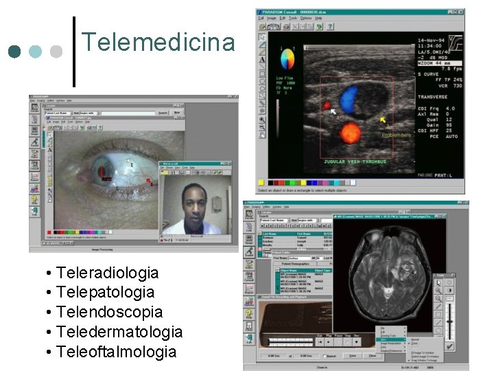 Telemedicina • Teleradiologia • Telepatologia • Telendoscopia • Teledermatologia • Teleoftalmologia Telemedicina • Teleradiologia • Telepatologia • Telendoscopia • Teledermatologia • Teleoftalmologia