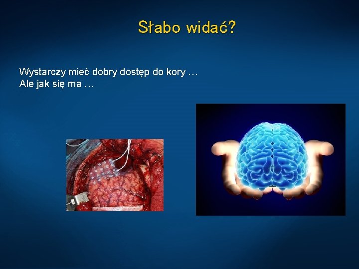 Słabo widać? Wystarczy mieć dobry dostęp do kory … Ale jak się ma …