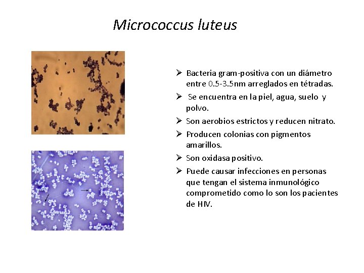 Micrococcus luteus Ø Bacteria gram-positiva con un diámetro entre 0. 5 -3. 5 nm