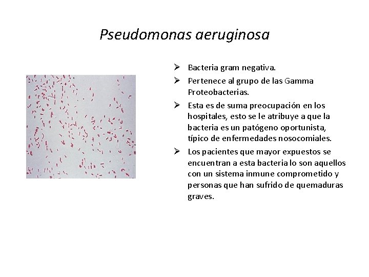 Pseudomonas aeruginosa Ø Bacteria gram negativa. Ø Pertenece al grupo de las Gamma Proteobacterias.