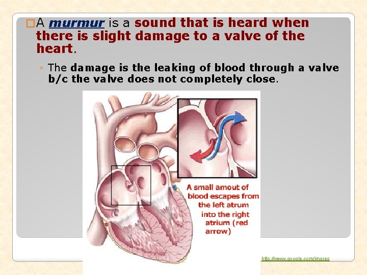 �A murmur is a sound that is heard when there is slight damage to �A murmur is a sound that is heard when there is slight damage to