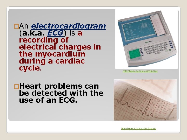 �An electrocardiogram (a. k. a. ECG) is a recording of electrical charges in the