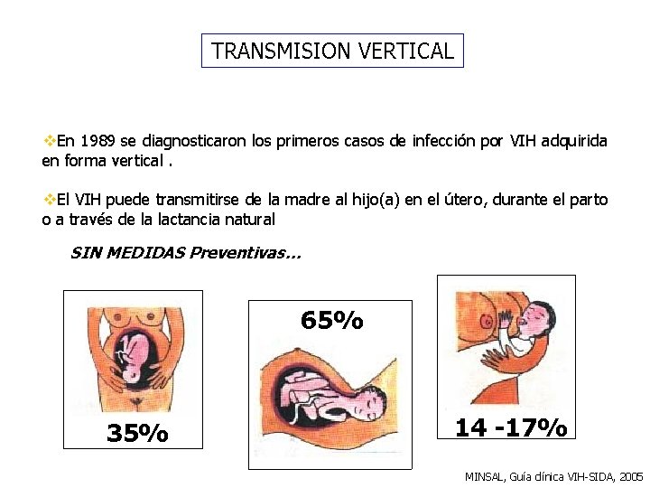 TRANSMISION VERTICAL v. En 1989 se diagnosticaron los primeros casos de infección por VIH