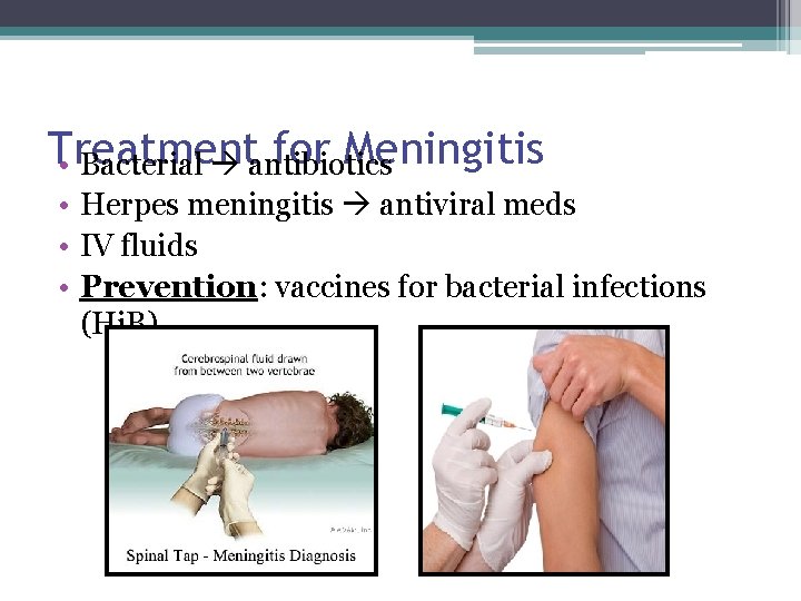 Treatment for Meningitis • Bacterial antibiotics • Herpes meningitis antiviral meds • IV fluids