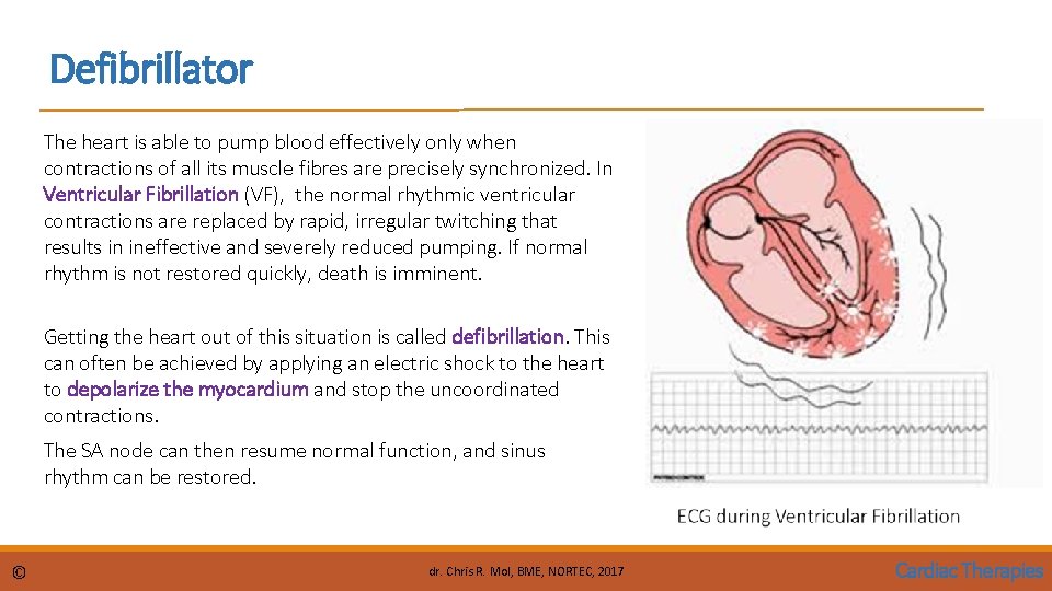 Defibrillator The heart is able to pump blood effectively only when contractions of all