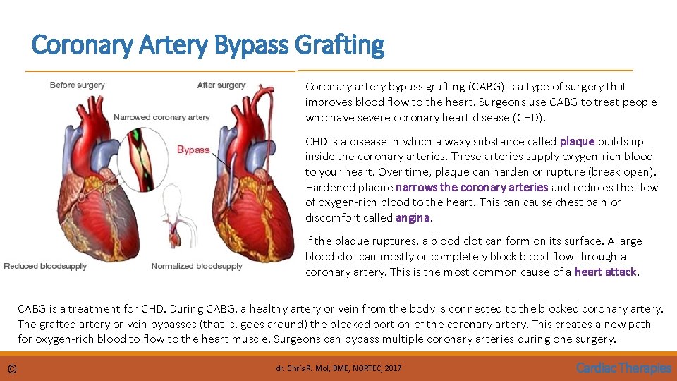 Coronary Artery Bypass Grafting Coronary artery bypass grafting (CABG) is a type of surgery