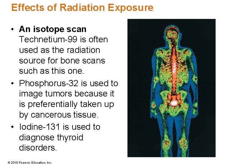 Effects of Radiation Exposure • An isotope scan Technetium-99 is often used as the