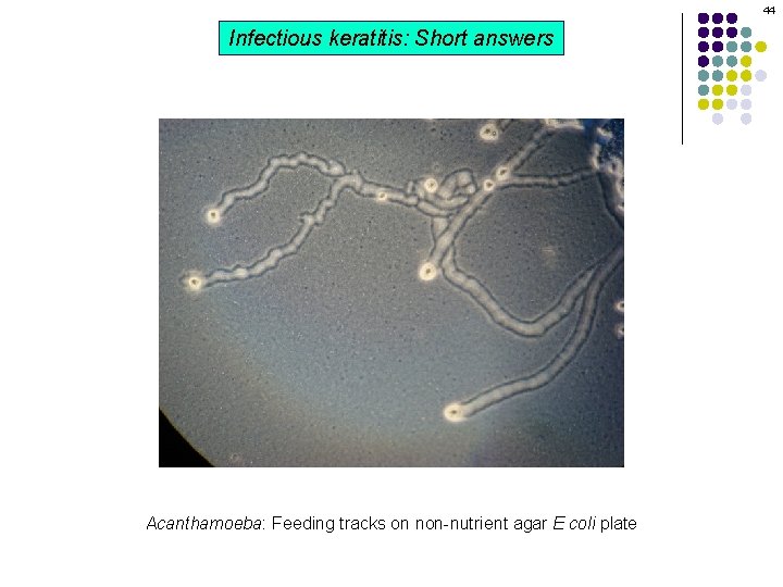 44 Infectious keratitis: Short answers Acanthamoeba: Feeding tracks on non-nutrient agar E coli plate 44 Infectious keratitis: Short answers Acanthamoeba: Feeding tracks on non-nutrient agar E coli plate