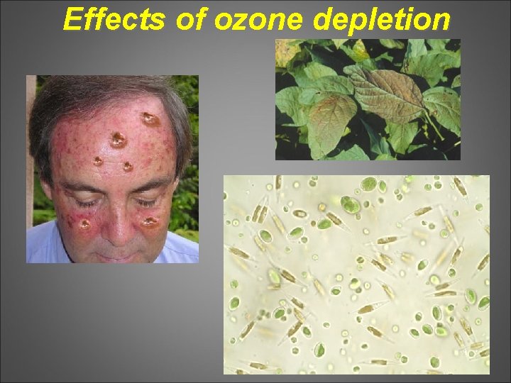 Effects of ozone depletion 