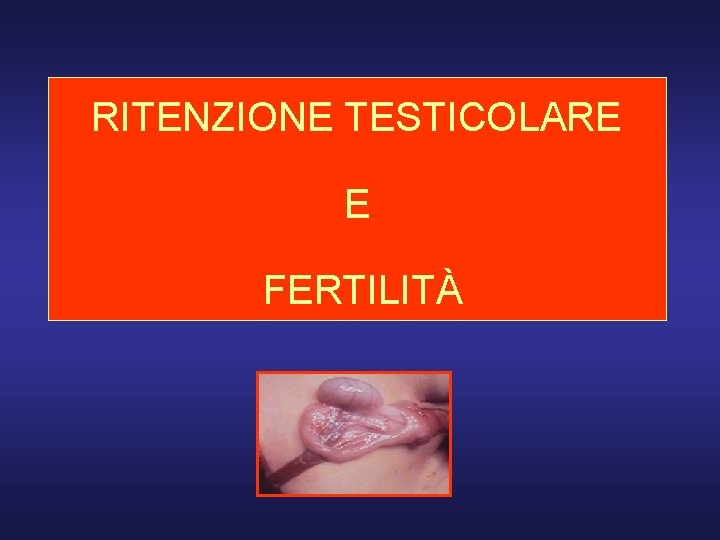 RITENZIONE TESTICOLARE E FERTILITÀ 