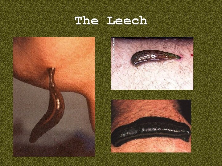 The Leech 