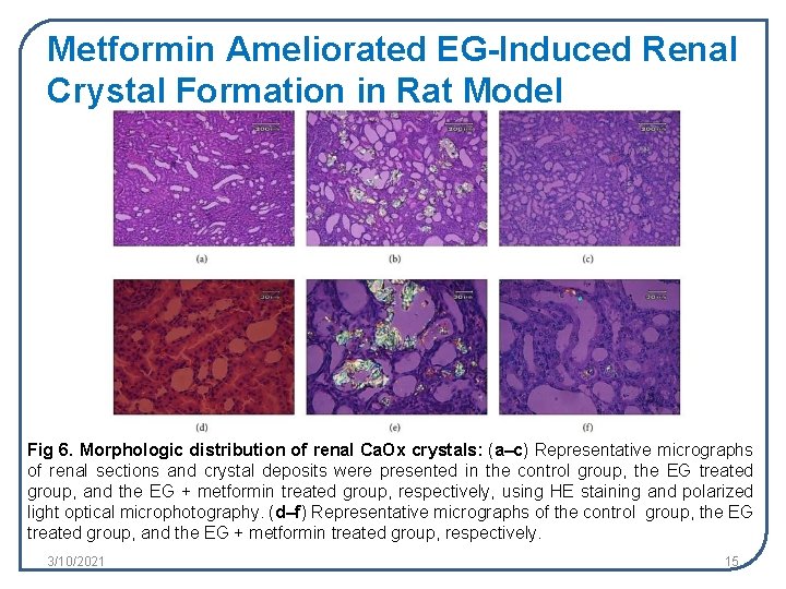 Metformin Ameliorated EG-Induced Renal Crystal Formation in Rat Model Fig 6. Morphologic distribution of