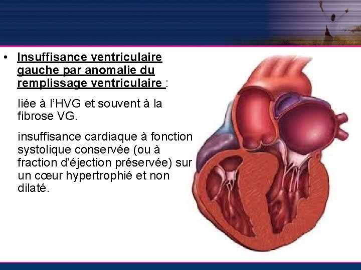  • Insuffisance ventriculaire gauche par anomalie du remplissage ventriculaire : liée à l’HVG