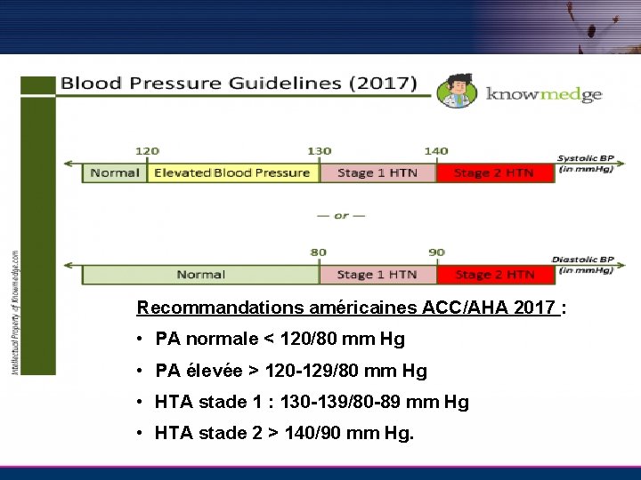 Recommandations américaines ACC/AHA 2017 : • PA normale < 120/80 mm Hg • PA