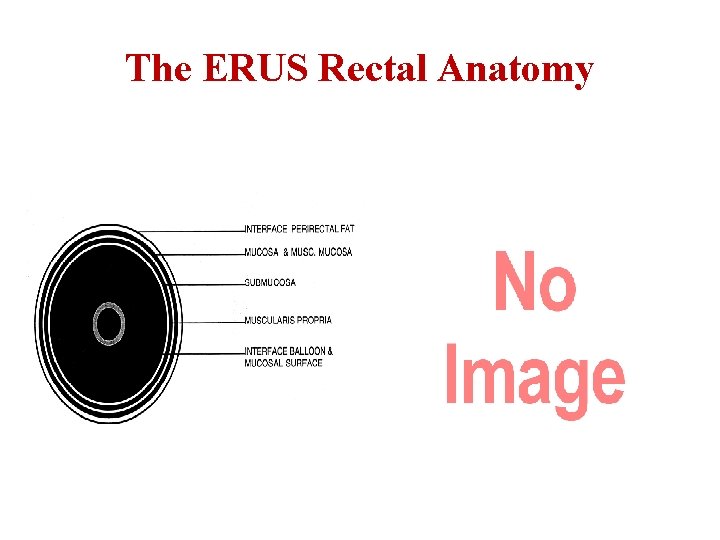The ERUS Rectal Anatomy 