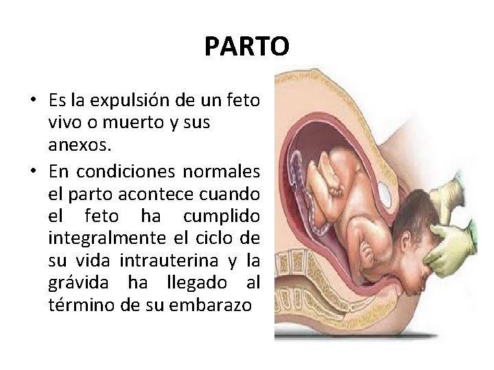 PARTO • Es la expulsión de un feto vivo o muerto y sus anexos. PARTO • Es la expulsión de un feto vivo o muerto y sus anexos.