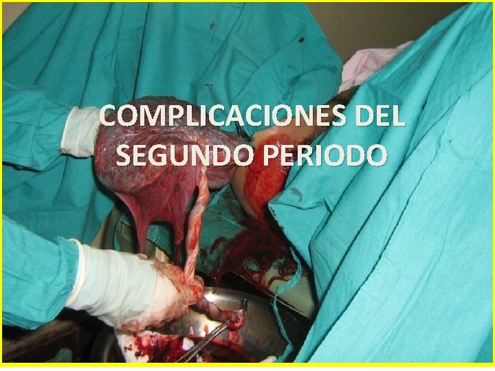 COMPLICACIONES DEL SEGUNDO PERIODO COMPLICACIONES DEL SEGUNDO PERIODO