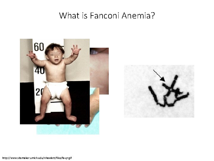 What is Fanconi Anemia? http: //www. sitemaker. umich. edu/nhowlett/files/fa-qr. gif 