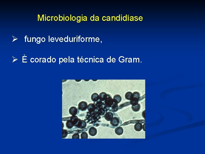 Microbiologia da candidíase Ø fungo leveduriforme, Ø È corado pela técnica de Gram. 