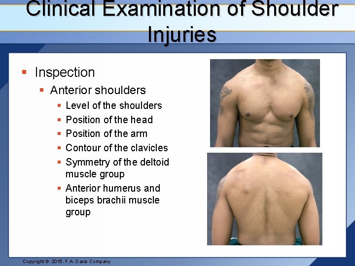 Clinical Examination of Shoulder Injuries § Inspection § Anterior shoulders § § § Level