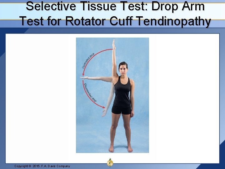 Selective Tissue Test: Drop Arm Test for Rotator Cuff Tendinopathy Copyright © 2015. F.